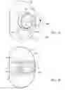Fig. 08 - Knee joint prosthesis system and method for implantation