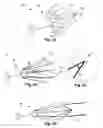 Fig. 03 - Gastrointestinal Prostheses