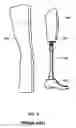 Fig. 02 - Prosthetic limb