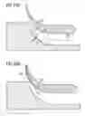 Fig. 10 - Burners for a gas turbine engine