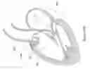 Fig. 131 - Method of making inflatable medical devices