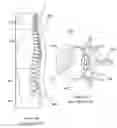 Fig. 90 - Method of making inflatable medical devices