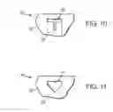 Fig. 07 - FLUID CONTROL VALVE AND VALVE BODY