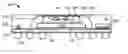 Fig. 01 - Mountable integrated circuit package-in-package system