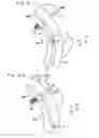Fig. 10 - Attachment structure of swash plate support and hydraulic apparatus