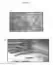 Fig. 06 - In vitro method for identifying compounds for cancer therapy