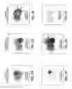 Fig. 03 - PATHOLOGICAL TISSUE DETECTION AND TREATMENT EMPLOYING TARGETED BENZOINDOLE OPTICAL AGENTS
