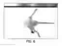 Fig. 06 - PATHOLOGICAL TISSUE DETECTION AND TREATMENT EMPLOYING TARGETED BENZOINDOLE OPTICAL AGENTS