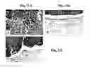 Fig. 12 - BIODEGRADABLE COMPOSITE FOR INTERNAL LOCAL RADIOTHERAPY