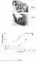 Fig. 14 - BIODEGRADABLE COMPOSITE FOR INTERNAL LOCAL RADIOTHERAPY