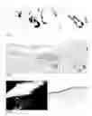 Fig. 02 - Methods for generating new hair follicles, treating baldness, and hair removal