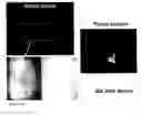 Fig. 09 - Methods for generating new hair follicles, treating baldness, and hair removal