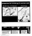 Fig. 10 - Methods for generating new hair follicles, treating baldness, and hair removal