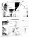 Fig. 12 - Methods for generating new hair follicles, treating baldness, and hair removal