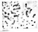 Fig. 41 - Methods for generating new hair follicles, treating baldness, and hair removal