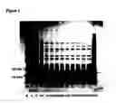 Fig. 08 - Basic protein purification tags from thermophilic bacteria