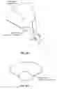 Fig. 16 - ACCESSING A BODY CAVITY THROUGH THE URINARY TRACT