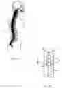 Fig. 02 - IMPLANTABLE NEURAL PROSTHETIC DEVICE AND METHODS OF USE