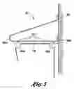 Fig. 09 - CERVICAL SPINE TRACTION APPARATUS AND METHOD