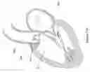 Fig. 131 - Inflatable medical devices