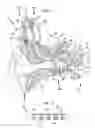 Fig. 02 - ELECTRODE ASSEMBLY FOR DELIVERING LONGITUDINAL AND RADIAL STIMULATION