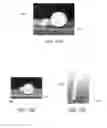 Fig. 07 - Artificial ligaments and tendons comprising multifilaments and nanofibers and methods for making