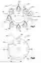 Fig. 07 - Method and apparatus for casting metal articles