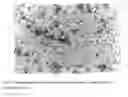 Fig. 02 - Pulmonary Insulin Crystals