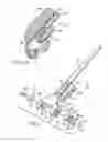 Fig. 02 - Prosthetic elbow replacement