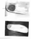 Fig. 107 - Method to capture and support a 3-D contour