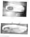 Fig. 108 - Method to capture and support a 3-D contour