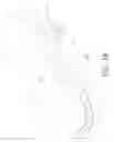 Fig. 20 - Method to capture and support a 3-D contour