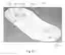 Fig. 63 - Method to capture and support a 3-D contour