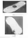 Fig. 68 - Method to capture and support a 3-D contour
