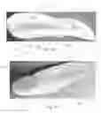 Fig. 78 - Method to capture and support a 3-D contour