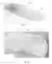 Fig. 82 - Method to capture and support a 3-D contour