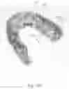 Fig. 94 - Method to capture and support a 3-D contour