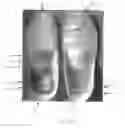 Fig. 98 - Method to capture and support a 3-D contour