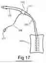 Fig. 15 - Measuring apparatus system and method