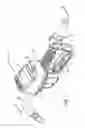 Fig. 02 - Seal-retaining valve for fluid metering device