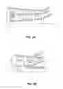 Fig. 08 - Blade shroud with aperture