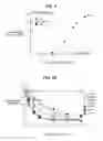 Fig. 05 - Methods of coronary imaging