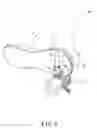 Fig. 06 - Safety structure for disassembling and positioning an airbag