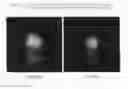 Fig. 02 - Method for treating hair growth disorders, such as female pattern alopecia, and compositions useful therefore