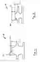 Fig. 08 - IMPLANTS FOR THE TREATMENT OF PELVIC FLOOR DISORDERS