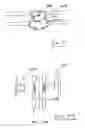 Fig. 18 - IMPLANTS FOR THE TREATMENT OF PELVIC FLOOR DISORDERS