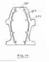 Fig. 19 - IMPLANTS FOR THE TREATMENT OF PELVIC FLOOR DISORDERS