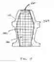 Fig. 20 - IMPLANTS FOR THE TREATMENT OF PELVIC FLOOR DISORDERS