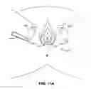 Fig. 24 - IMPLANTS FOR THE TREATMENT OF PELVIC FLOOR DISORDERS