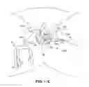 Fig. 26 - IMPLANTS FOR THE TREATMENT OF PELVIC FLOOR DISORDERS